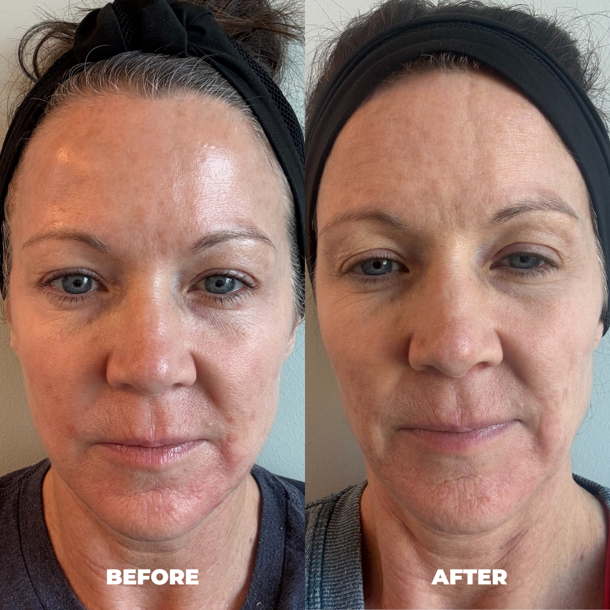 Before and after result