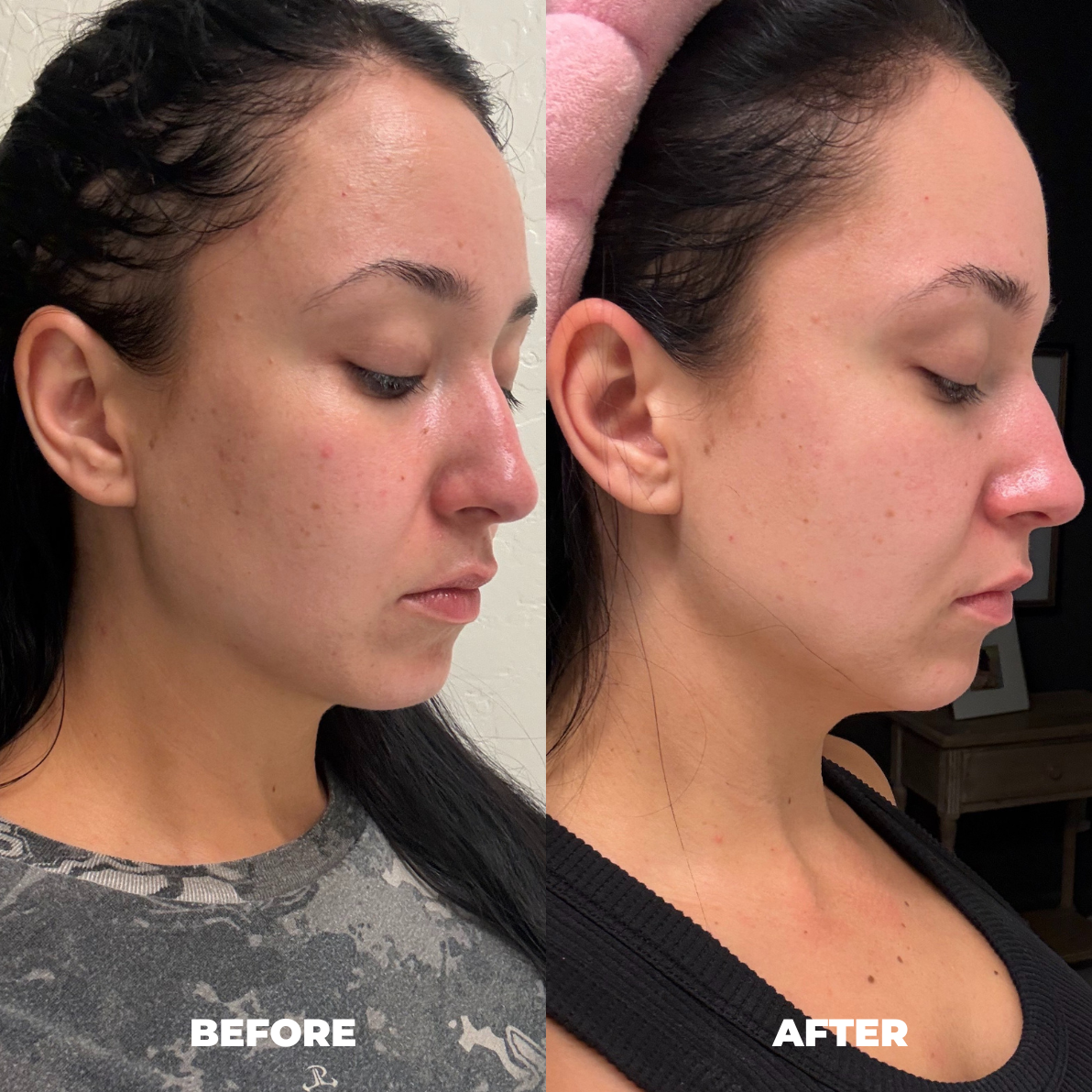 Before and after result