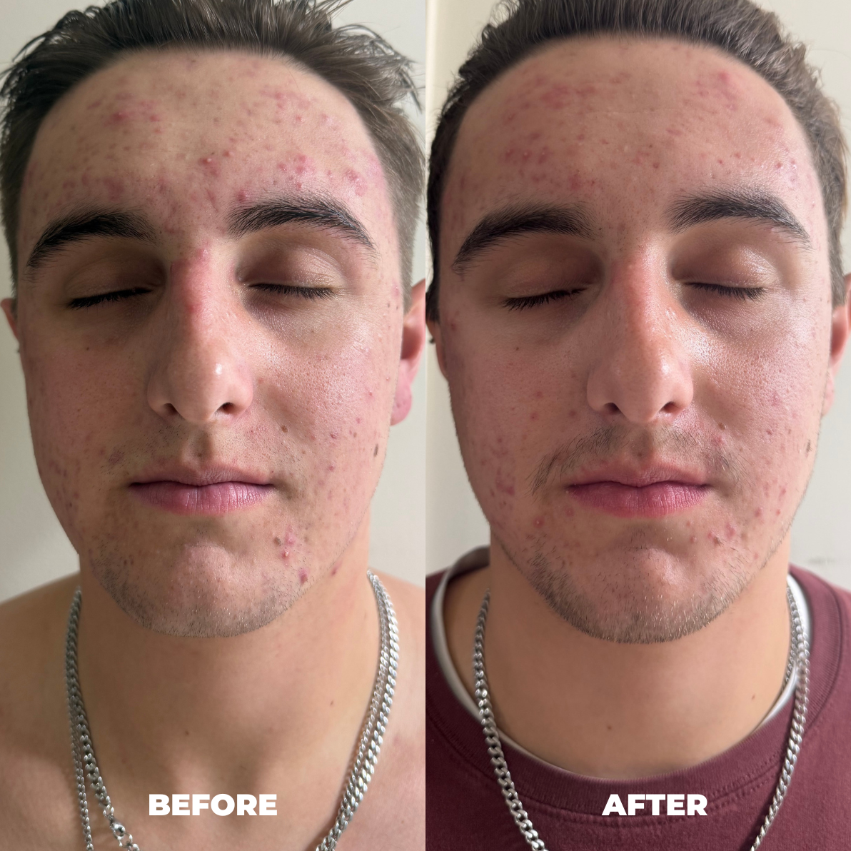 Before and after result