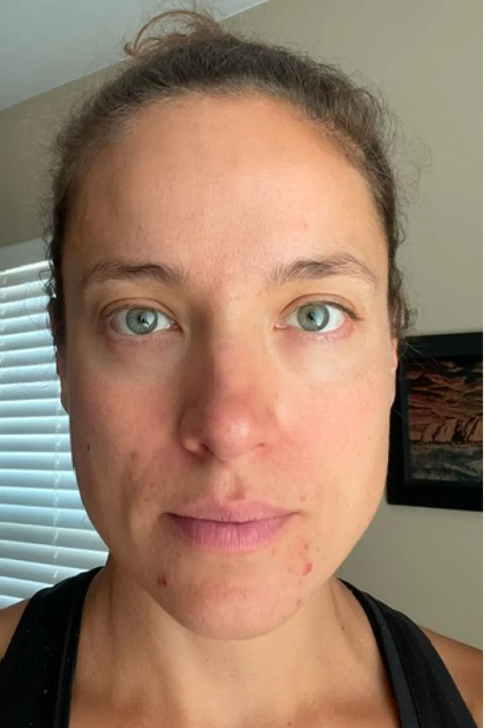 Lauren C. before
